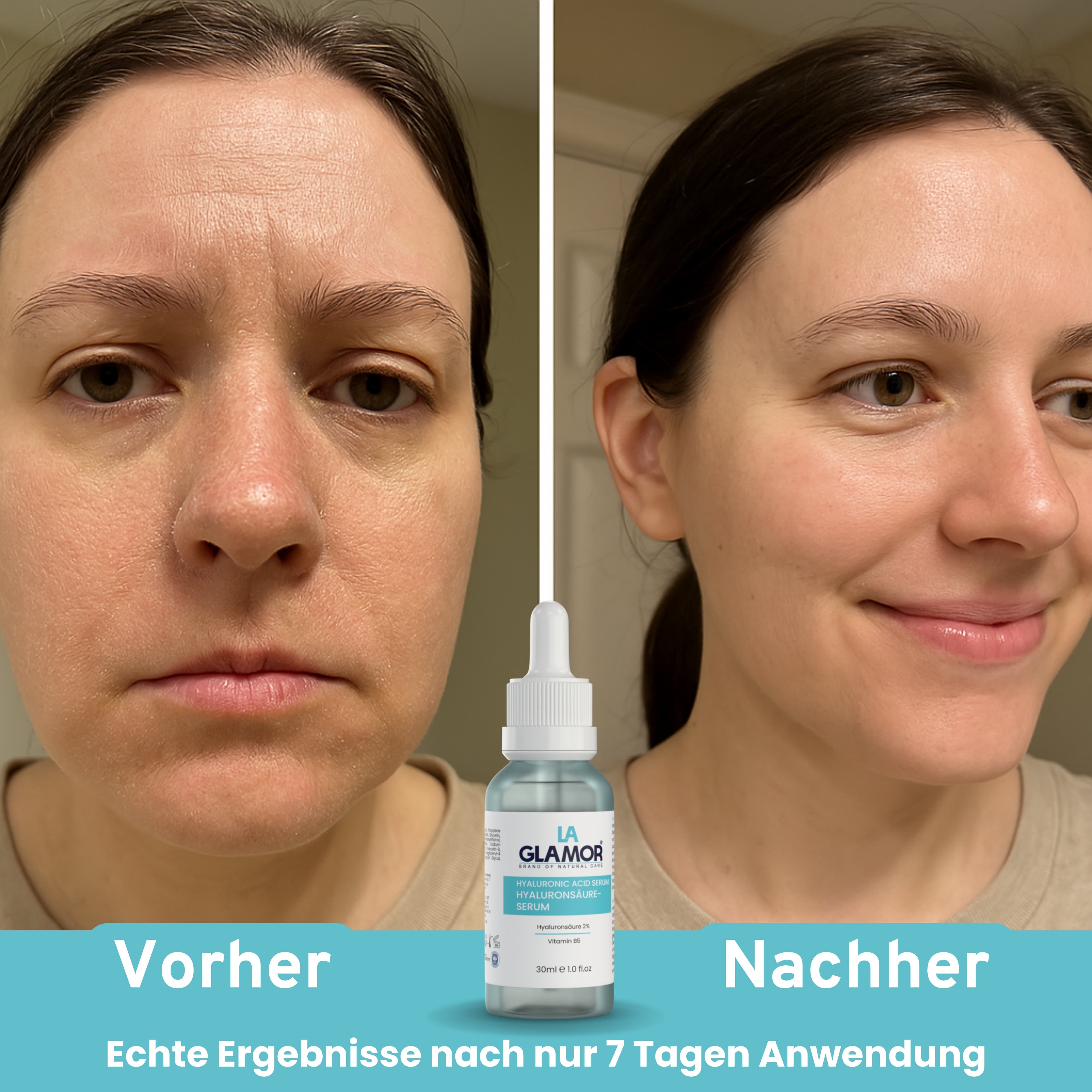 LAGLAMOR® Hyaluronsäure Serum - 30ml Glasflasche